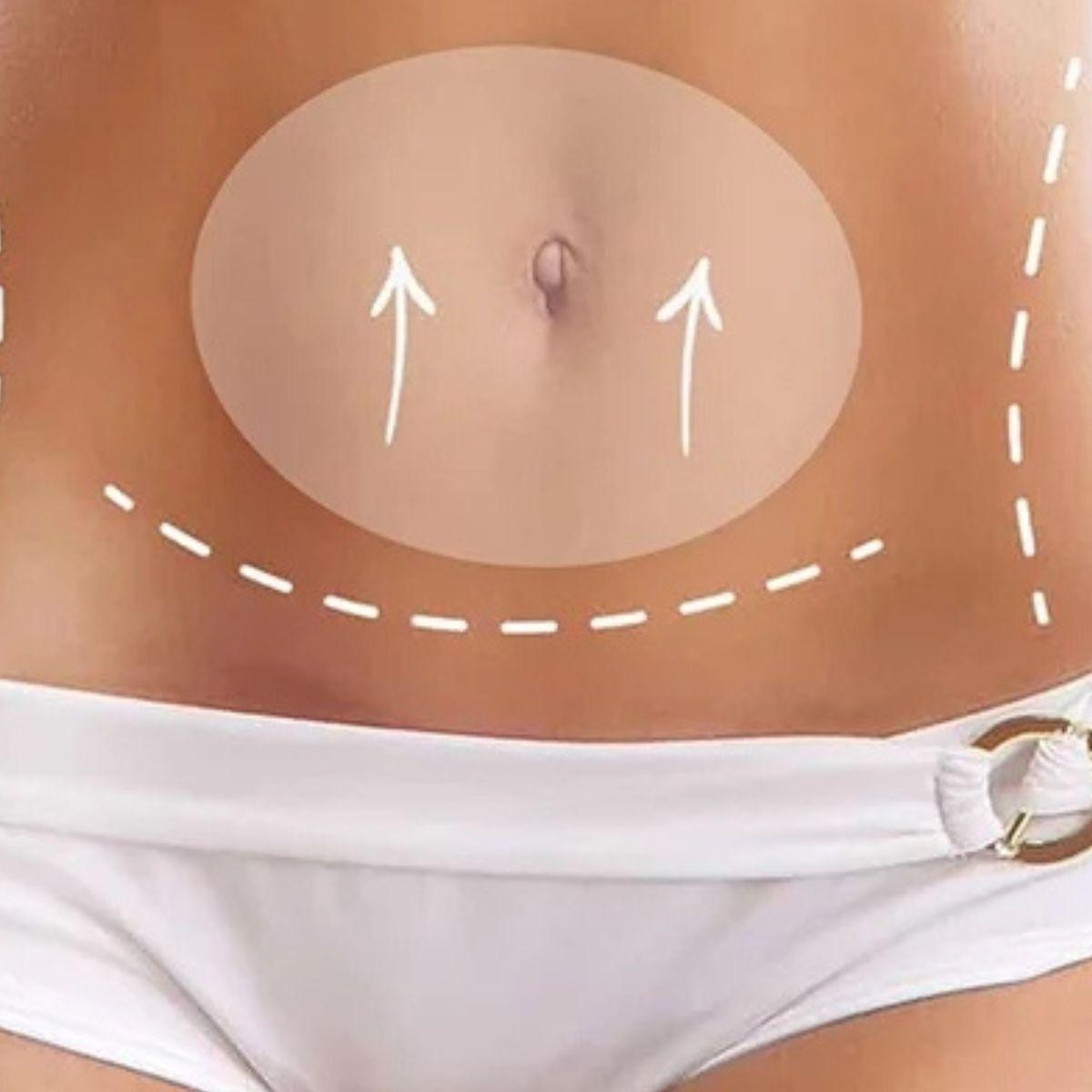 SET 5 PARCHES ADELGAZANTE QUEMA GRASA PARA ABDOMEN LAU-3