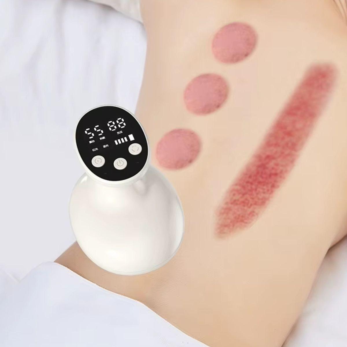 MASAJEADOR RASPADOR PIE INTELIGENTE RECARGABLE MUSCULAR LAU-3