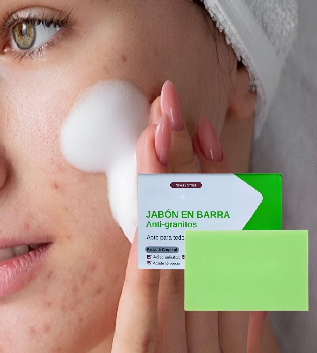 Set 4 Jabón Anti Acné Granos Espinillas Cara Cuerpo Jhn-2