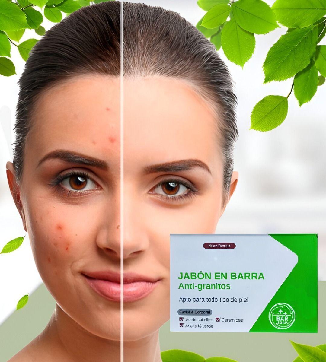 Set 4 Jabón Anti Acné Granos Espinillas Cara Cuerpo Jhn-3