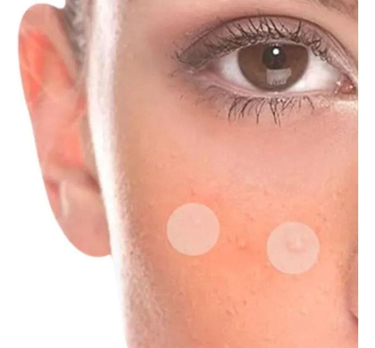 SET 6 PARCHES PARA ACNE HIDROCOLOIDES CICATRIZANTE LAU-9