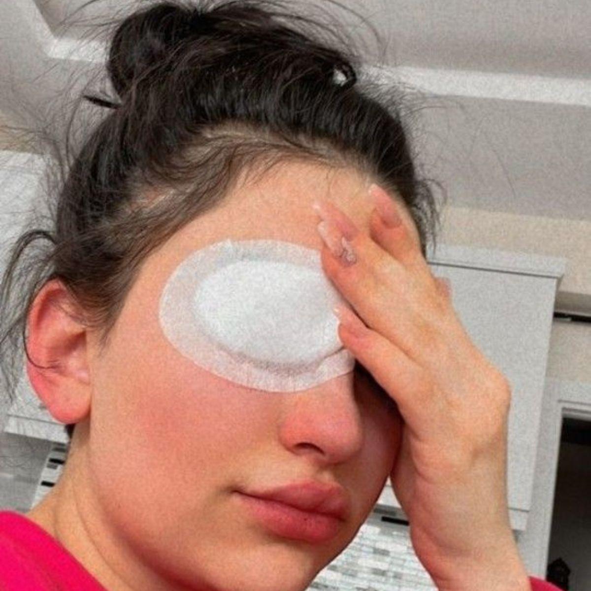 SET 4 PACK PARCHE OCULAR DE ADULTO ADHESIVO ESTERIL LAU-2