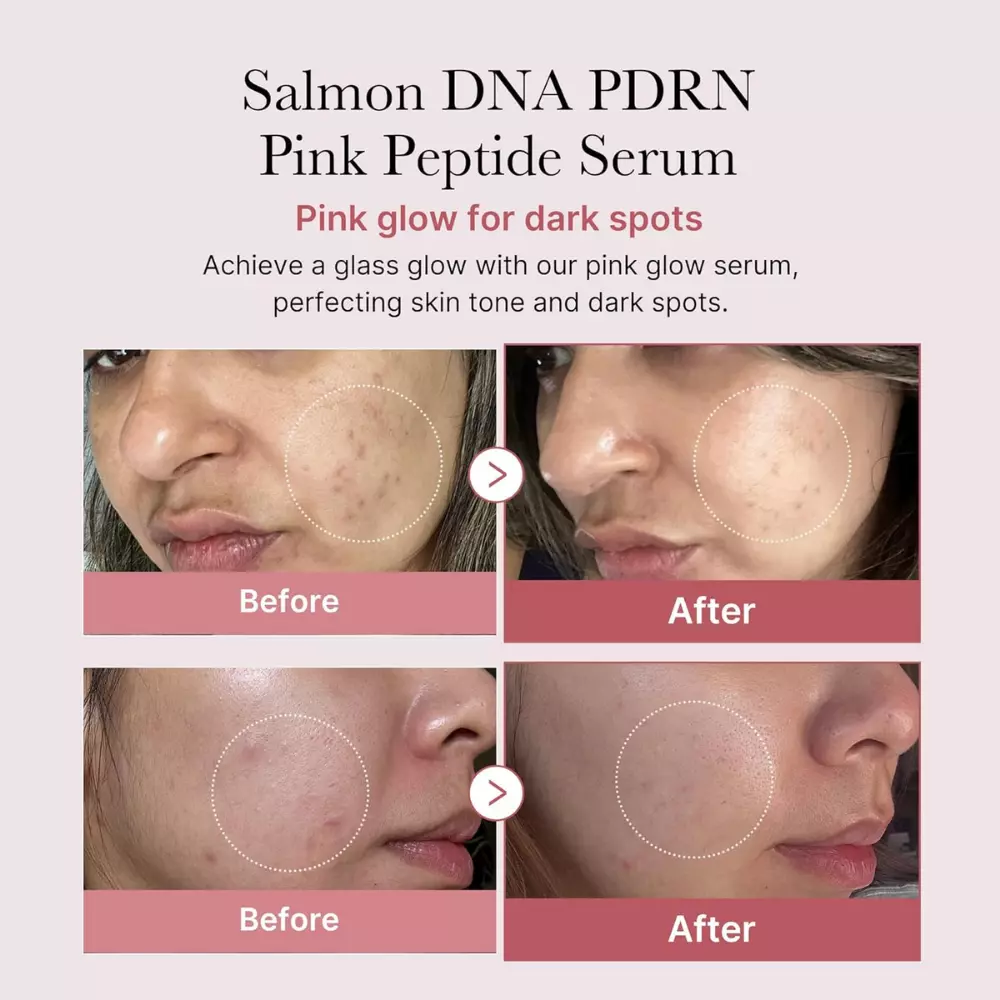 Medicube PDRN Pink Peptide Serum 30ml-3