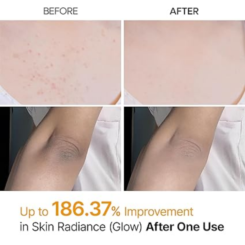 Dr Melaxin Peel Shot Exfoliating Kojic Acid Tumeric Spray 200ml-4