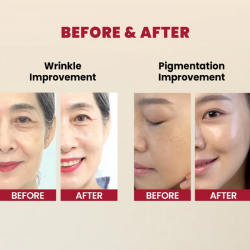 K SECRET SEOUL 1988 Serum Retinal Liposome 2 Black Ginseng 30ml-3