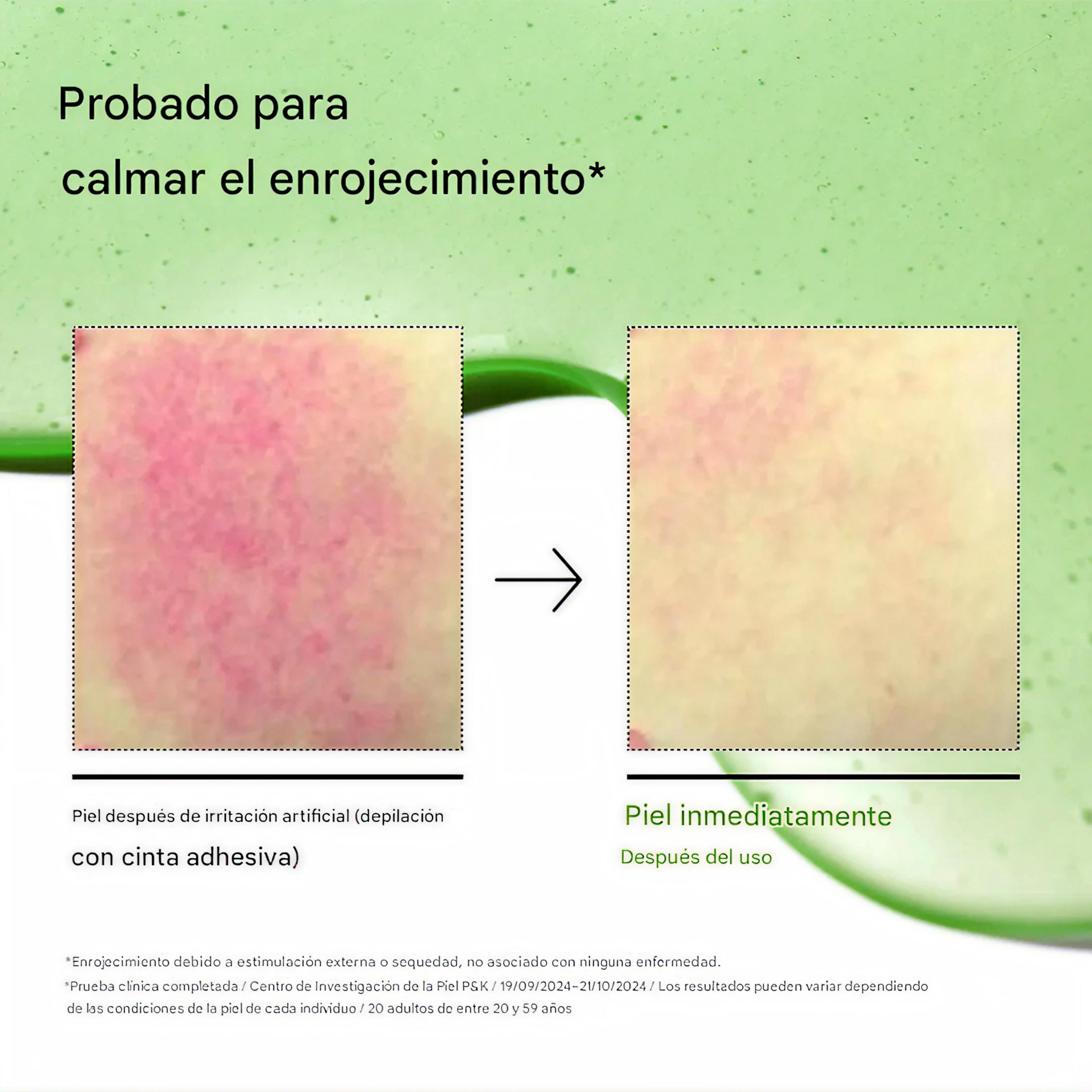 Azelaic Acid 10 Hyaluron Redness Soothing Serum 30ml-6