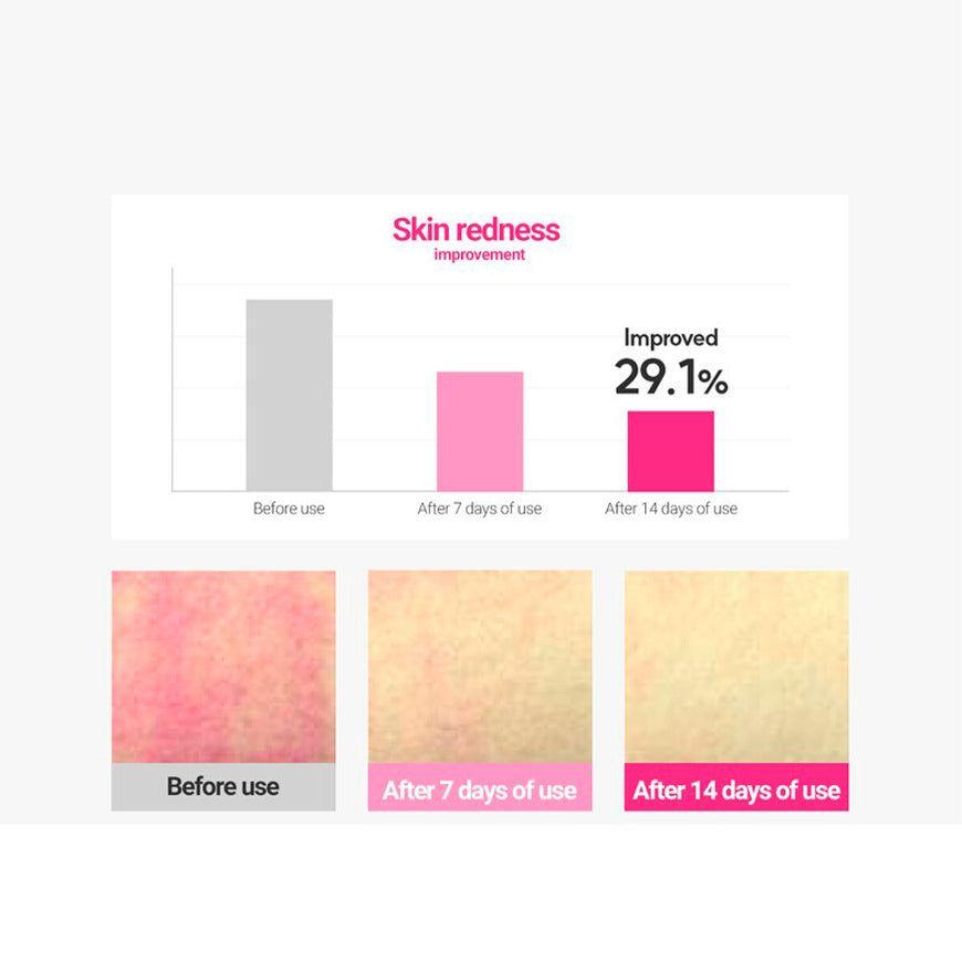 Crema Facial Cica Piel Clara Y Sin Manchas-2