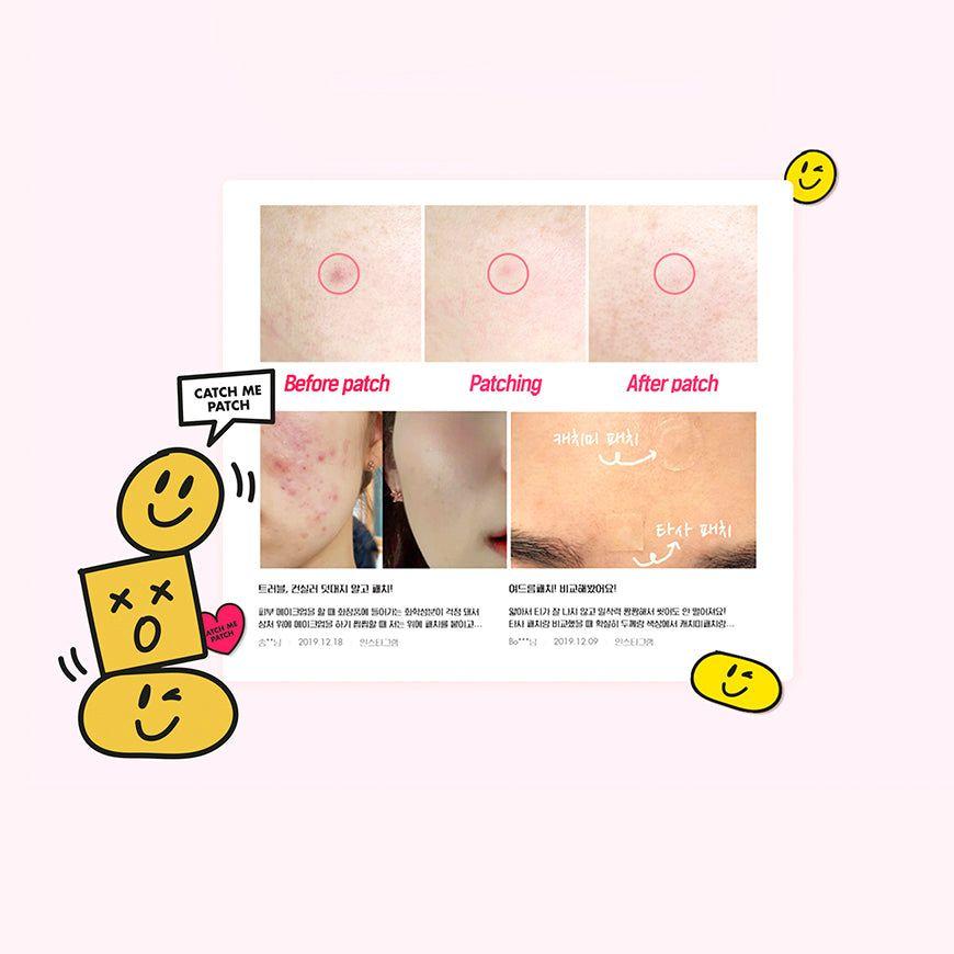 Parches Facial Acné Clean Touch-2