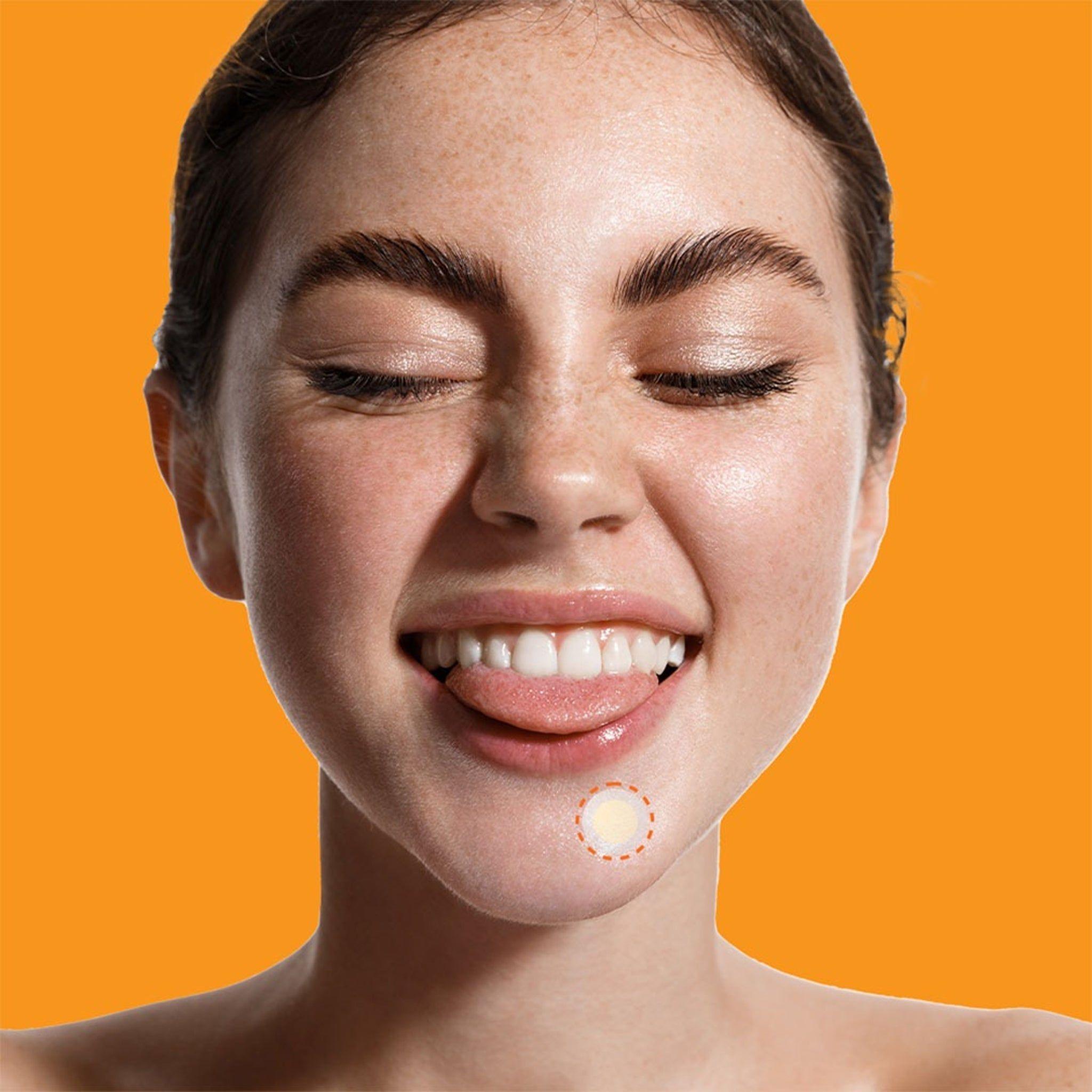 Nico Medical Parches Faciales para Manchas y Cuidado de la Piel Cosmética Coreana -6