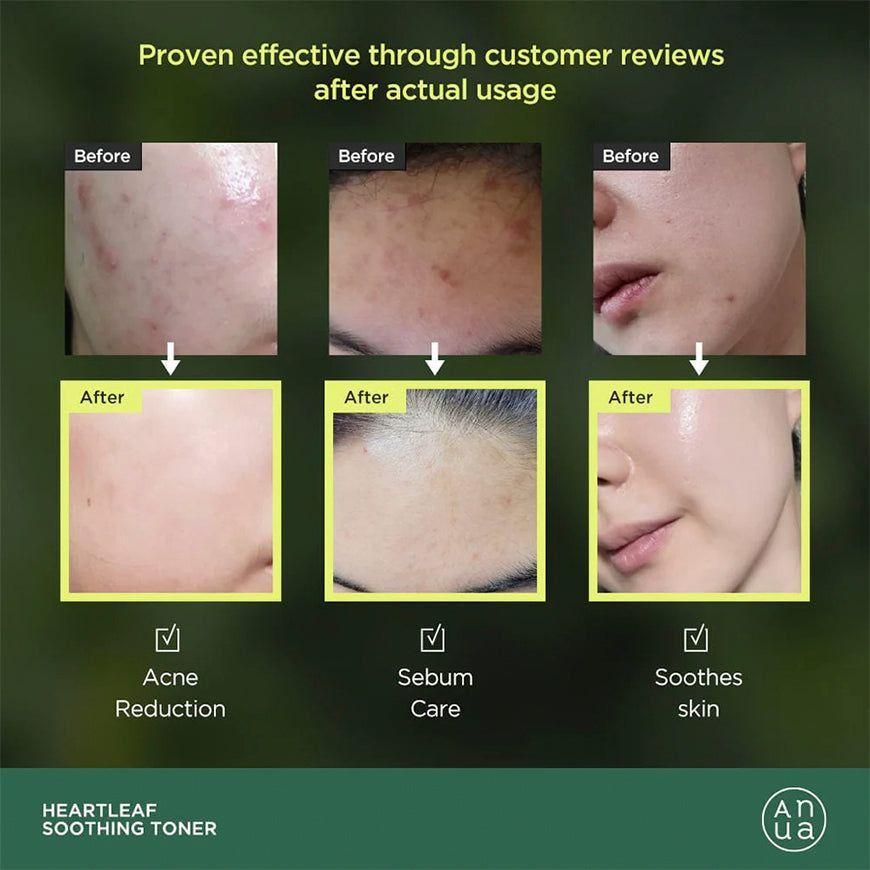 ANUA Tónico Facial Calmante con Heartleaf 77% 250 ml-2