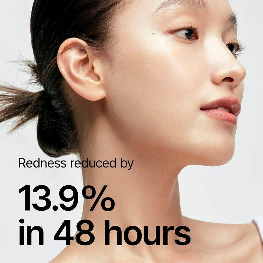 ANUA Tónico Facial Calmante con Heartleaf 77% 250 ml-3