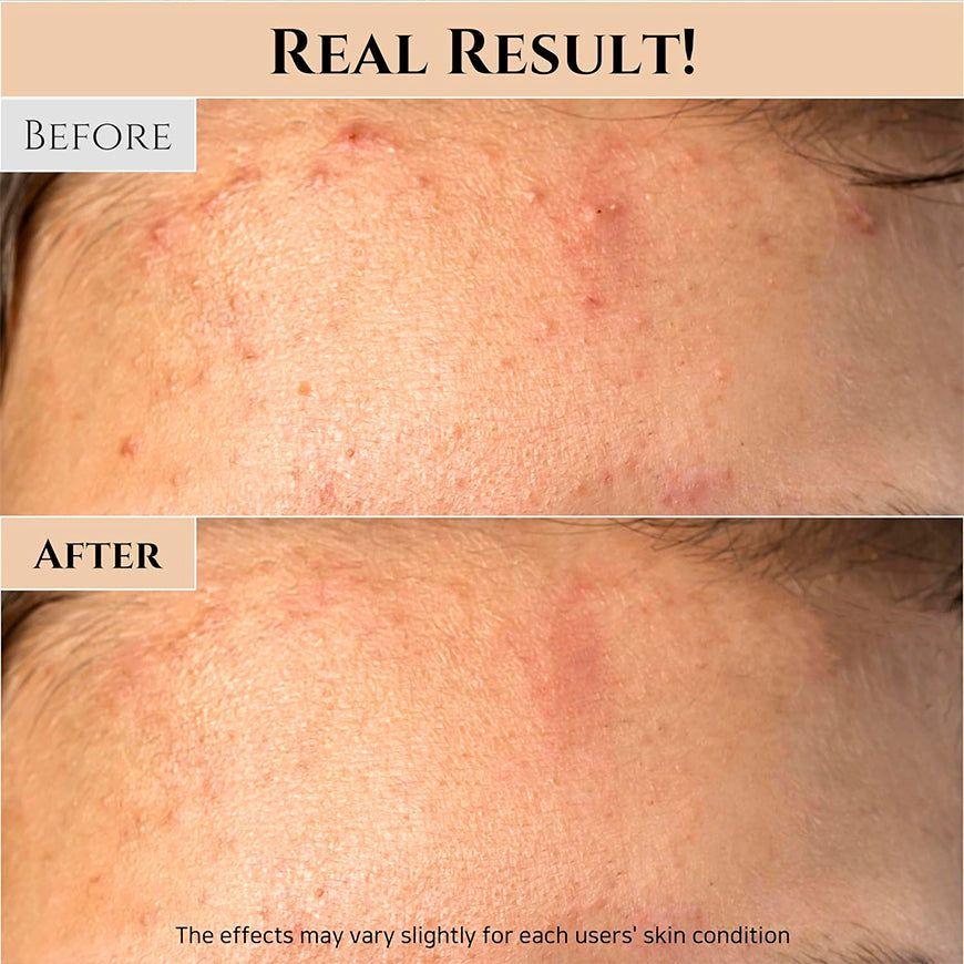 Beauty of Joseon Mascarilla Facial Exfoliante de Arroz y Miel Cosmética Coreana 150 g-4