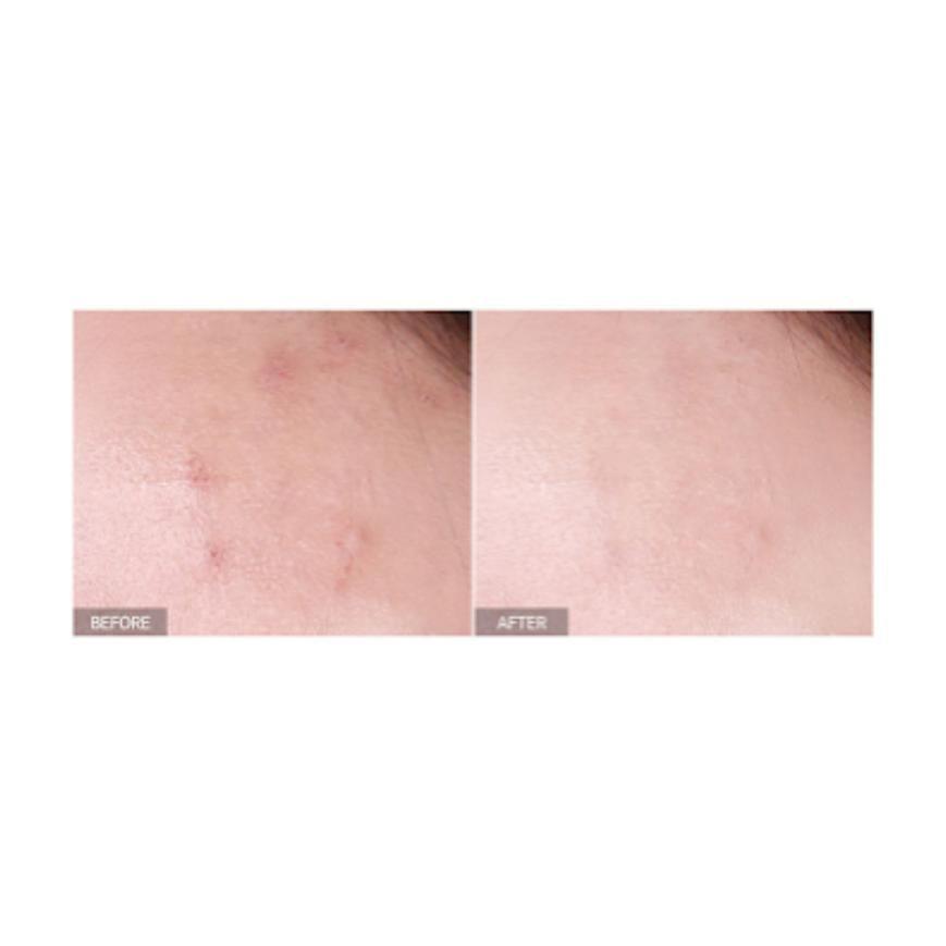 Serum antimanchas con Niacinamida y Arbutina-3