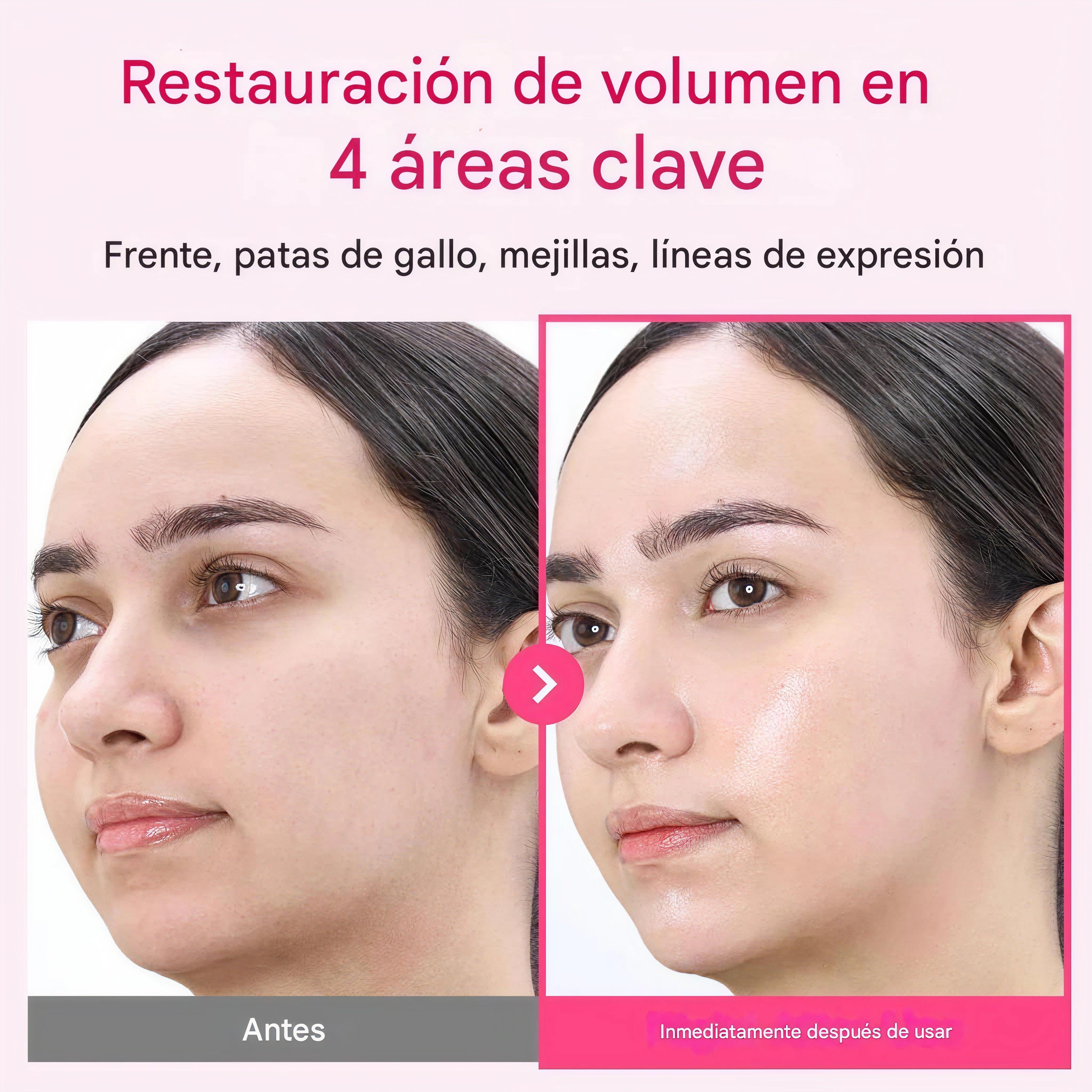 No.2 Rose PDRN Collagen Plumping Sheet Mask-5