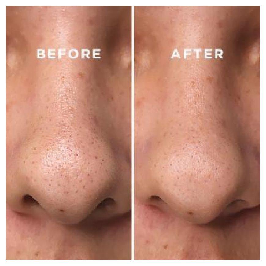 Tónico coreano para suavizar la piel con agua de corteza de sauce blanco - COSRX Two in One Poreless-2
