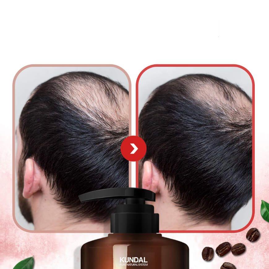 Champú coreano anti-caída con cafeína y ácido salicílico - KUNDAL Baby Powder-2