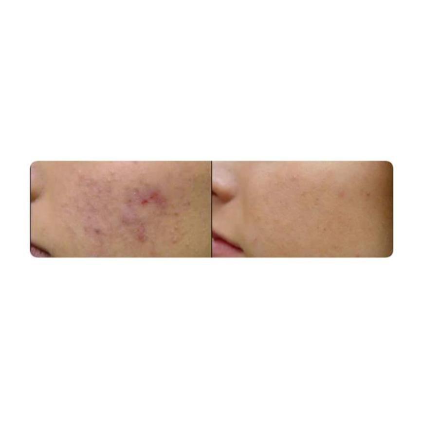 Shooting gel con 99% de aloe vera-1