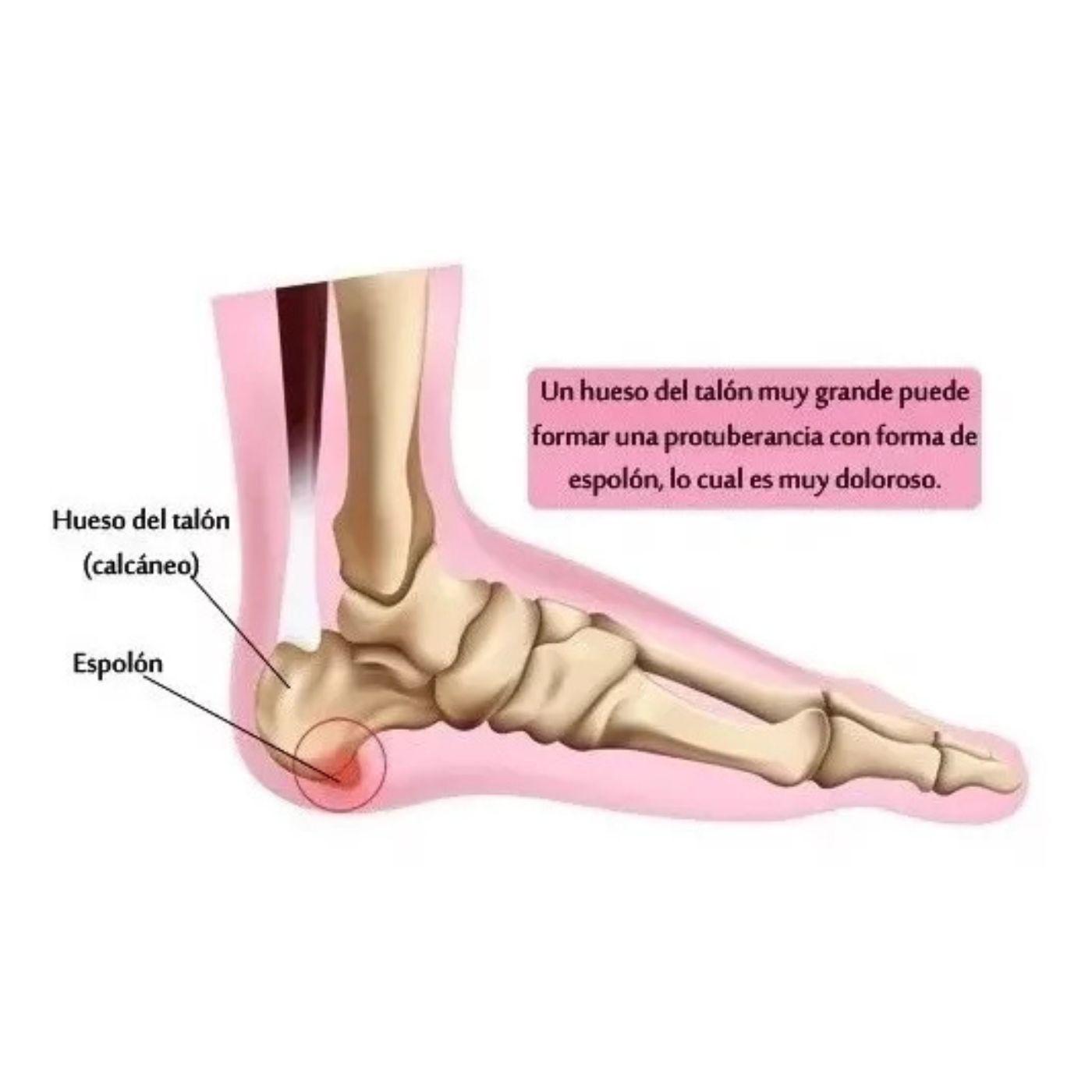 Par Plantillas Ortopédicas Ajustables Espolón Mujer 674-6