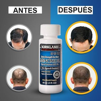 Imagen 2 del producto Minoxdil Kirkland 60ml Crecimiento Cabello Extrafuerte Usp5%