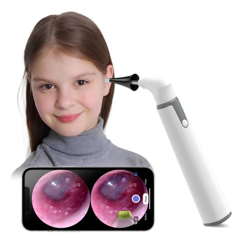 Otoscopio Inalámbrico Wifi Con Cámara De Oído -0