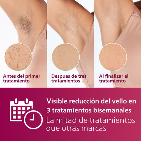 Depiladora Laser Ipl Philips Bri920/00 Lumea Advanced-4