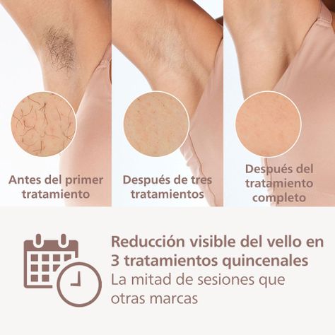 Depiladora Ipl Philips Lumea Prestige Bri947-4