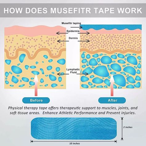 Tape Kinesiológico Precortado Azul 5cm x 5mt Recovery Original-4