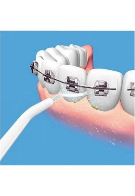 Irrigador Dental Limpieza Bucal PREMIUM h2O-1