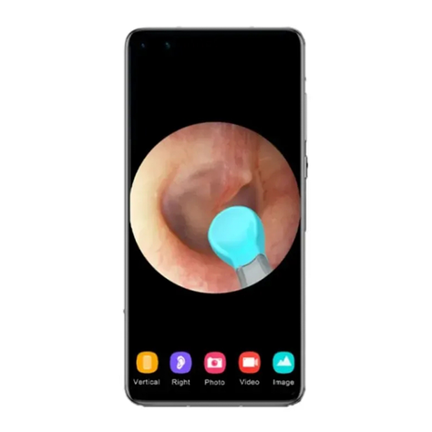 Limpia Oido Limpiador Oreja Usb Cámara Hd Endoscópica-3