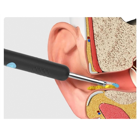 Limpia Oido Limpiador Oreja Usb Cámara Hd Endoscópica-7