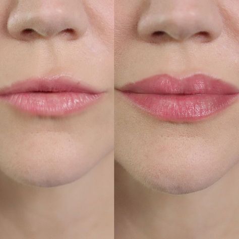 Lip Boost - 2 Estuches con 2 frascos (2 Meses)-5