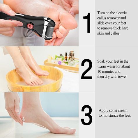 Pedicura Callos Pies Electrico Profesional Mujer Rondon-4