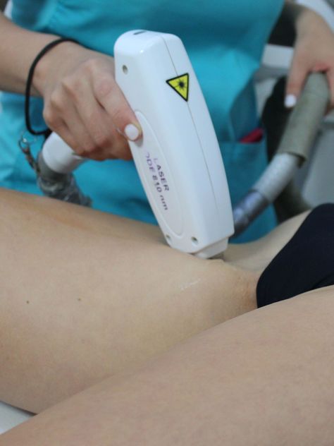 Depilación Láser Cuerpo Completo-1