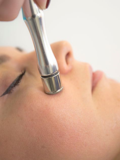 4 Sesiones de Peeling-2