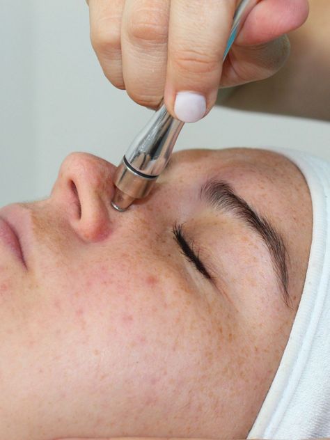 4 Sesiones de Peeling-1