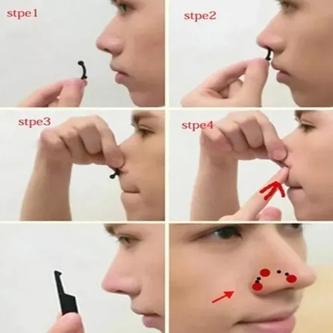 Corrector Nasal Respingador De Nariz Instantaneo-1