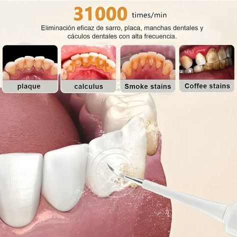 Kit Cepillo Limpiador Dental Eléctrico Ultrasónico Removedor-4