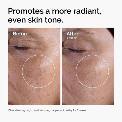 Glycolic Acid 7% Solucion Acido Glicolico The Ordinary 240ml-3