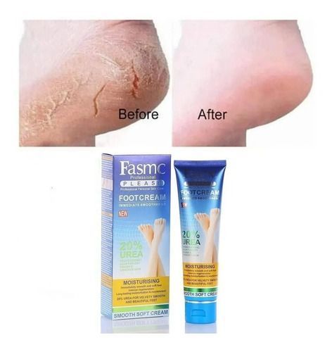 Crema Para Pies 25% Urea Diabetes Suaviza Hidratante-2