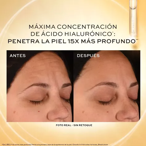 Concentre Serum Facial Relleno Arruga 15% Hyaluronic Complex-4