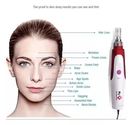Dermapen Terapia Facial Con Microagujas Marca MYM-3