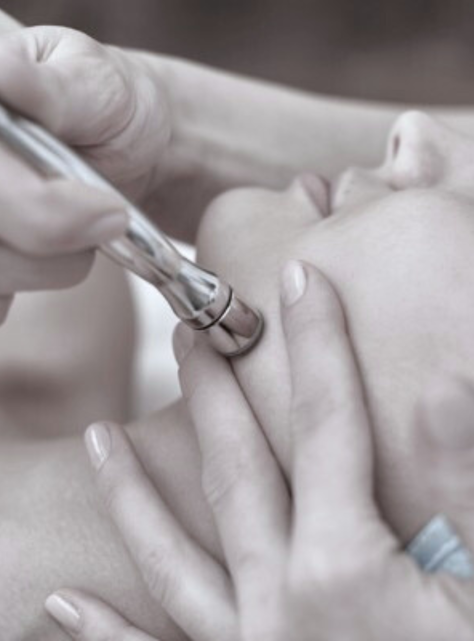 Limpieza Facial Con Dermoabrasión Punta Diamante.-0