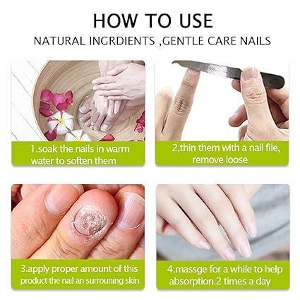 Elimina Hongos En Uñas Onicomicosis Nueva Formula-3