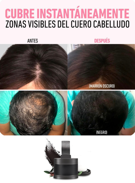 Polvo Capilar Para Relleno De Entradas,canas En Pelo O Barba-4