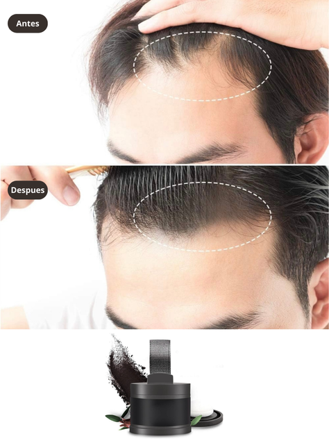 Polvo Capilar Para Relleno De Entradas,canas En Pelo O Barba-2