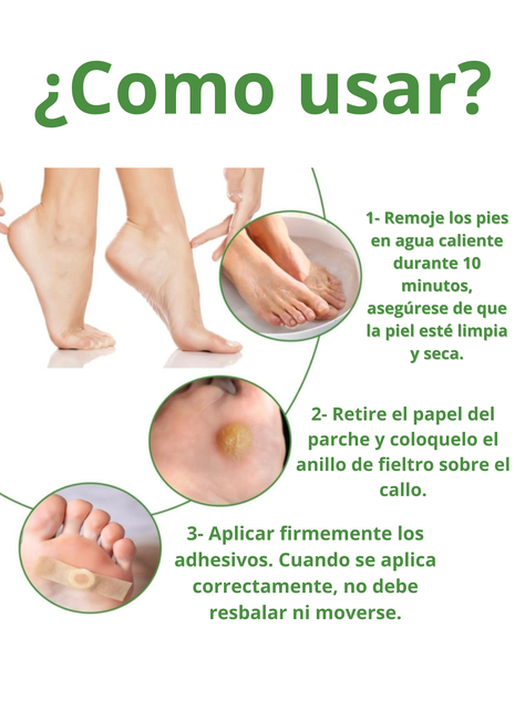 Caja De Parches Quita Callos Y Verrugas Corporales En Piel-2