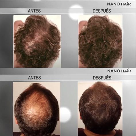 Recarga polvo microfibra Alopecia Nano Hair 50gr Castaño Medio-1