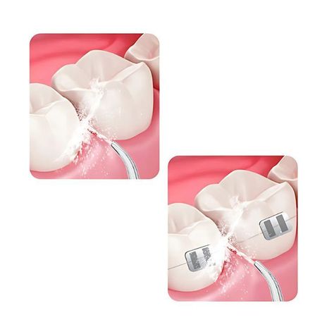 Limpiador Dental Portatil USB Irrigador Bucal-5
