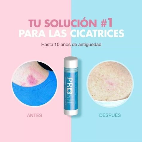Prosil Para Tratamiento Profesional De Cicatrices - 4,25 Gr-1