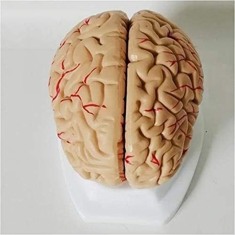 Cerebro con arterias desarmable-2